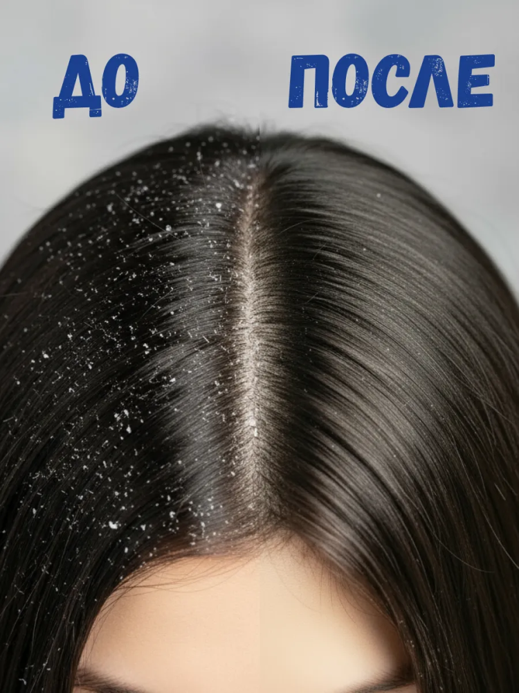 HEAD & SHOULDERS Шампунь и Бальзам 2 в 1 " Гладкие и Шелковистые" 360 мл.,Румыния { 84174 } фото-4